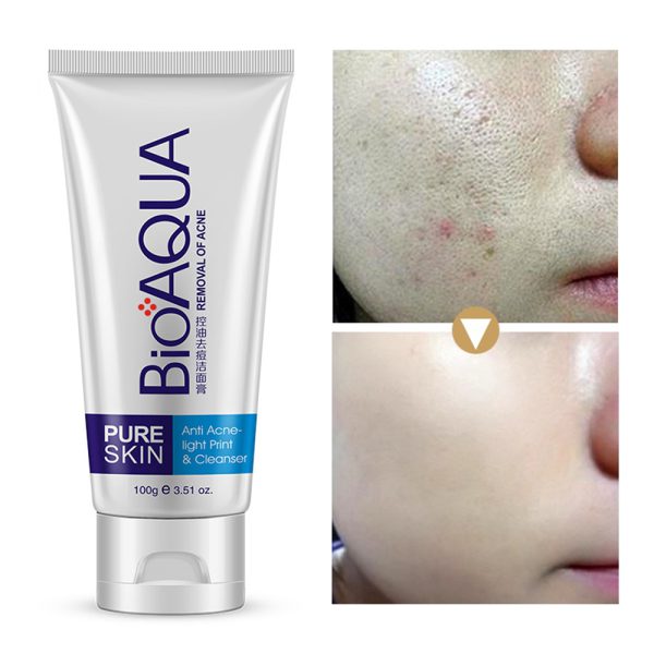 Acne Cleanser